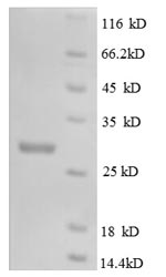 SDS-PAGE separation of QP8587 followed by commassie total protein stain results in a primary band consistent with reported data for M-CSF / CSF-1. These data demonstrate Greater than 90% as determined by SDS-PAGE.