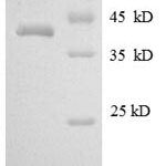 SDS-PAGE separation of QP8589 followed by commassie total protein stain results in a primary band consistent with reported data for Myelin protein P0. These data demonstrate Greater than 90% as determined by SDS-PAGE.