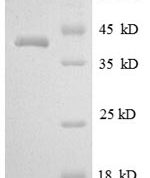 SDS-PAGE separation of QP8589 followed by commassie total protein stain results in a primary band consistent with reported data for Myelin protein P0. These data demonstrate Greater than 90% as determined by SDS-PAGE.