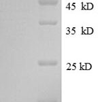 SDS-PAGE separation of QP8591 followed by commassie total protein stain results in a primary band consistent with reported data for CALR / Calreticulin. These data demonstrate Greater than 85.1% as determined by SDS-PAGE.