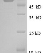 SDS-PAGE separation of QP8591 followed by commassie total protein stain results in a primary band consistent with reported data for CALR / Calreticulin. These data demonstrate Greater than 85.1% as determined by SDS-PAGE.