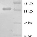 SDS-PAGE separation of QP8592 followed by commassie total protein stain results in a primary band consistent with reported data for CXCL13 / BCA-1 / BLC. These data demonstrate Greater than 90% as determined by SDS-PAGE.