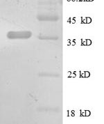 SDS-PAGE separation of QP8592 followed by commassie total protein stain results in a primary band consistent with reported data for CXCL13 / BCA-1 / BLC. These data demonstrate Greater than 90% as determined by SDS-PAGE.