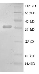 SDS-PAGE separation of QP8592 followed by commassie total protein stain results in a primary band consistent with reported data for CXCL13 / BCA-1 / BLC. These data demonstrate Greater than 90% as determined by SDS-PAGE.