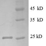 SDS-PAGE separation of QP8595 followed by commassie total protein stain results in a primary band consistent with reported data for LTBR / TNFRSF3. These data demonstrate Greater than 90% as determined by SDS-PAGE.