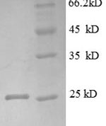 SDS-PAGE separation of QP8595 followed by commassie total protein stain results in a primary band consistent with reported data for LTBR / TNFRSF3. These data demonstrate Greater than 90% as determined by SDS-PAGE.