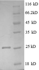 SDS-PAGE separation of QP8595 followed by commassie total protein stain results in a primary band consistent with reported data for LTBR / TNFRSF3. These data demonstrate Greater than 90% as determined by SDS-PAGE.