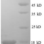 SDS-PAGE separation of QP8596 followed by commassie total protein stain results in a primary band consistent with reported data for RELT / TNFRSF19L. These data demonstrate Greater than 90% as determined by SDS-PAGE.