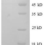 SDS-PAGE separation of QP8598 followed by commassie total protein stain results in a primary band consistent with reported data for IL-8 / CXCL8. These data demonstrate Greater than 90.5% as determined by SDS-PAGE.