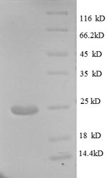 SDS-PAGE separation of QP8600 followed by commassie total protein stain results in a primary band consistent with reported data for Major capsid protein L1. These data demonstrate Greater than 90% as determined by SDS-PAGE.