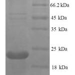 SDS-PAGE separation of QP8604 followed by commassie total protein stain results in a primary band consistent with reported data for TNFRSF11A. These data demonstrate Greater than 90% as determined by SDS-PAGE.