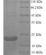 SDS-PAGE separation of QP8604 followed by commassie total protein stain results in a primary band consistent with reported data for TNFRSF11A. These data demonstrate Greater than 90% as determined by SDS-PAGE.