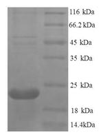 SDS-PAGE separation of QP8604 followed by commassie total protein stain results in a primary band consistent with reported data for TNFRSF11A. These data demonstrate Greater than 90% as determined by SDS-PAGE.