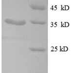 SDS-PAGE separation of QP8616 followed by commassie total protein stain results in a primary band consistent with reported data for 30S ribosomal protein S21. These data demonstrate Greater than 90% as determined by SDS-PAGE.