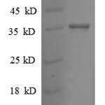 SDS-PAGE separation of QP8618 followed by commassie total protein stain results in a primary band consistent with reported data for 30S ribosomal protein S18. These data demonstrate Greater than 90% as determined by SDS-PAGE.