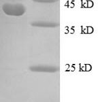 SDS-PAGE separation of QP8622 followed by commassie total protein stain results in a primary band consistent with reported data for 30S ribosomal protein S10. These data demonstrate Greater than 90% as determined by SDS-PAGE.