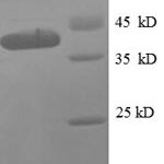 SDS-PAGE separation of QP8623 followed by commassie total protein stain results in a primary band consistent with reported data for 50S ribosomal protein L9. These data demonstrate Greater than 90% as determined by SDS-PAGE.