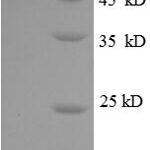 SDS-PAGE separation of QP8640 followed by commassie total protein stain results in a primary band consistent with reported data for CXCL3 / GRO gamma. These data demonstrate Greater than 90% as determined by SDS-PAGE.