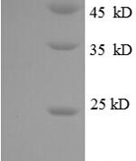 SDS-PAGE separation of QP8640 followed by commassie total protein stain results in a primary band consistent with reported data for CXCL3 / GRO gamma. These data demonstrate Greater than 90% as determined by SDS-PAGE.