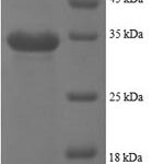 SDS-PAGE separation of QP8641 followed by commassie total protein stain results in a primary band consistent with reported data for NAP-2 / PPBP / CXCL7. These data demonstrate Greater than 90% as determined by SDS-PAGE.