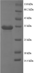 SDS-PAGE separation of QP8641 followed by commassie total protein stain results in a primary band consistent with reported data for NAP-2 / PPBP / CXCL7. These data demonstrate Greater than 90% as determined by SDS-PAGE.