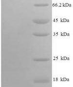 SDS-PAGE separation of QP8647 followed by commassie total protein stain results in a primary band consistent with reported data for C-C motif chemokine 9. These data demonstrate Greater than 90% as determined by SDS-PAGE.