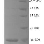 SDS-PAGE separation of QP8649 followed by commassie total protein stain results in a primary band consistent with reported data for C-C motif chemokine 25. These data demonstrate Greater than 90% as determined by SDS-PAGE.