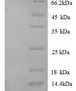 SDS-PAGE separation of QP8650 followed by commassie total protein stain results in a primary band consistent with reported data for CXCL1 / MGSA / NAP-3. These data demonstrate Greater than 90% as determined by SDS-PAGE.