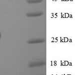 SDS-PAGE separation of QP8653 followed by commassie total protein stain results in a primary band consistent with reported data for CXCL5 / ENA-78. These data demonstrate Greater than 90% as determined by SDS-PAGE.