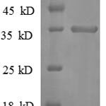 SDS-PAGE separation of QP8655 followed by commassie total protein stain results in a primary band consistent with reported data for CXCL10 / Crg-2. These data demonstrate Greater than 90% as determined by SDS-PAGE.