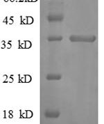 SDS-PAGE separation of QP8655 followed by commassie total protein stain results in a primary band consistent with reported data for CXCL10 / Crg-2. These data demonstrate Greater than 90% as determined by SDS-PAGE.