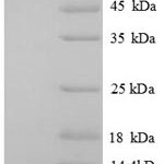 SDS-PAGE separation of QP8657 followed by commassie total protein stain results in a primary band consistent with reported data for CXCL12 / SDF-1. These data demonstrate Greater than 90% as determined by SDS-PAGE.