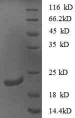 SDS-PAGE separation of QP8659 followed by commassie total protein stain results in a primary band consistent with reported data for CXCL16 / SR-PSOX. These data demonstrate Greater than 90% as determined by SDS-PAGE.