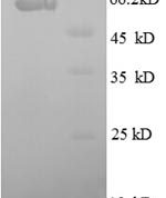SDS-PAGE separation of QP8664 followed by commassie total protein stain results in a primary band consistent with reported data for Osteonectin / SPARC. These data demonstrate Greater than 90% as determined by SDS-PAGE.