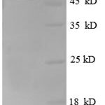 SDS-PAGE separation of QP8665 followed by commassie total protein stain results in a primary band consistent with reported data for Fibroblast growth factor 5. These data demonstrate Greater than 90% as determined by SDS-PAGE.