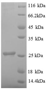 SDS-PAGE separation of QP8668 followed by commassie total protein stain results in a primary band consistent with reported data for Ubiquitin-conjugating enzyme E2 K. These data demonstrate Greater than 90% as determined by SDS-PAGE.