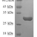 SDS-PAGE separation of QP8669 followed by commassie total protein stain results in a primary band consistent with reported data for Substance-P receptor. These data demonstrate Greater than 90% as determined by SDS-PAGE.