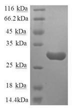 SDS-PAGE separation of QP8669 followed by commassie total protein stain results in a primary band consistent with reported data for Substance-P receptor. These data demonstrate Greater than 90% as determined by SDS-PAGE.