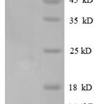 SDS-PAGE separation of QP8670 followed by commassie total protein stain results in a primary band consistent with reported data for Oncostatin M / OSM. These data demonstrate Greater than 90% as determined by SDS-PAGE.