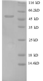 SDS-PAGE separation of QP8670 followed by commassie total protein stain results in a primary band consistent with reported data for Oncostatin M / OSM. These data demonstrate Greater than 90% as determined by SDS-PAGE.