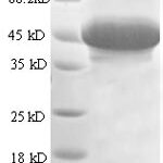 SDS-PAGE separation of QP8677 followed by commassie total protein stain results in a primary band consistent with reported data for STC-1 / Stanniocalcin-1. These data demonstrate Greater than 80% as determined by SDS-PAGE.