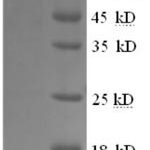 SDS-PAGE separation of QP8681 followed by commassie total protein stain results in a primary band consistent with reported data for Glycogen phosphorylase