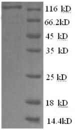 SDS-PAGE separation of QP8681 followed by commassie total protein stain results in a primary band consistent with reported data for Glycogen phosphorylase