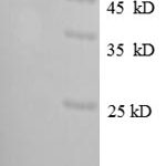 SDS-PAGE separation of QP8686 followed by commassie total protein stain results in a primary band consistent with reported data for Glutathione S-transferase P. These data demonstrate Greater than 90% as determined by SDS-PAGE.