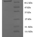 SDS-PAGE separation of QP8689 followed by commassie total protein stain results in a primary band consistent with reported data for CD146 / MCAM. These data demonstrate Greater than 90% as determined by SDS-PAGE.