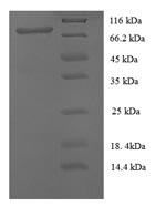 SDS-PAGE separation of QP8689 followed by commassie total protein stain results in a primary band consistent with reported data for CD146 / MCAM. These data demonstrate Greater than 90% as determined by SDS-PAGE.