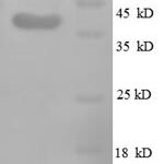 SDS-PAGE separation of QP8694 followed by commassie total protein stain results in a primary band consistent with reported data for Midkine / MDK Protein. These data demonstrate Greater than 90% as determined by SDS-PAGE.