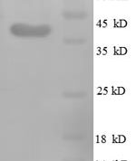 SDS-PAGE separation of QP8694 followed by commassie total protein stain results in a primary band consistent with reported data for Midkine / MDK Protein. These data demonstrate Greater than 90% as determined by SDS-PAGE.