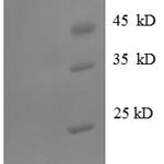 SDS-PAGE separation of QP8707 followed by commassie total protein stain results in a primary band consistent with reported data for GRP94 / HSP90B1. These data demonstrate Greater than 90% as determined by SDS-PAGE.