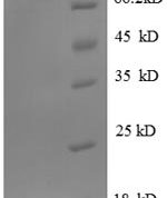 SDS-PAGE separation of QP8707 followed by commassie total protein stain results in a primary band consistent with reported data for GRP94 / HSP90B1. These data demonstrate Greater than 90% as determined by SDS-PAGE.